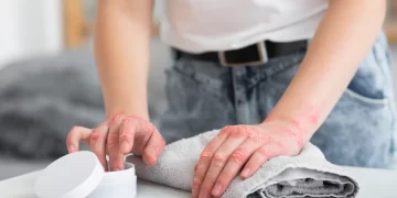 بیماری های پوستی