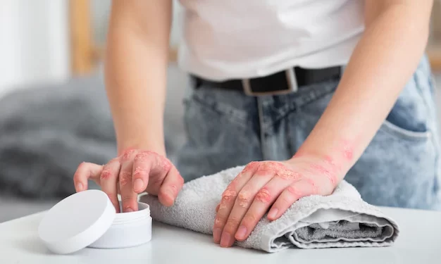 بیماری های پوستی