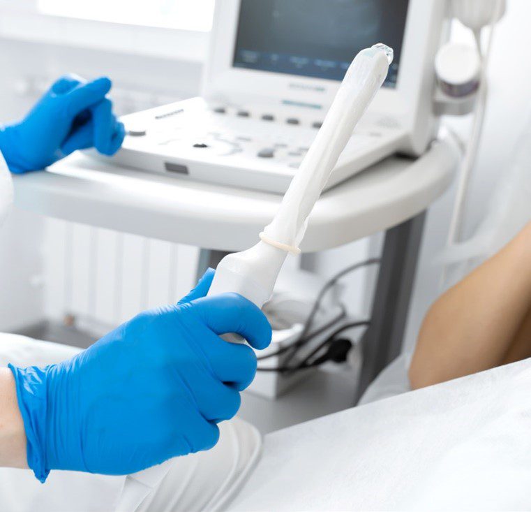 Point of Care Ultrasound Probe Reprocessing
