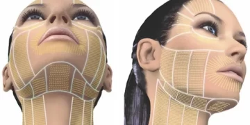 اولتراسوند صورت