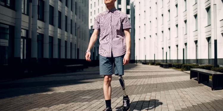 کاشت پای مصنوعی به روش ایمپلنت اندو-اکسو 1 کاشت پای مصنوعی