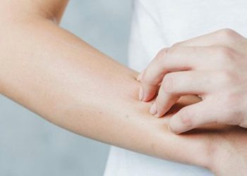 دارو برای خارش بدن