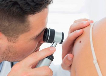 زگیل تناسلی در دختران مجرد