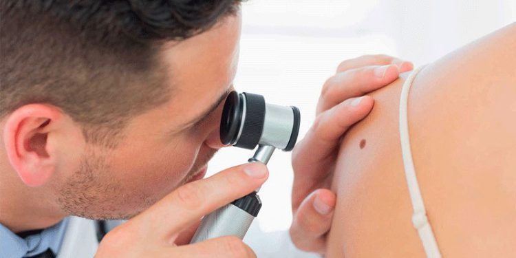 علت زگیل تناسلی در دختران مجرد چیست؟ 1 زگیل تناسلی در دختران مجرد