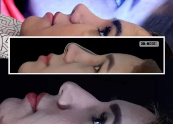 اطلاعات کامل درباره لیفت بینی و تاثیرات آن بر زیبایی چهره