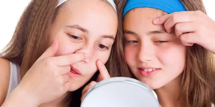 راه های مراقبت از پوست در دوران نوجوانی 1 مراقبت از پوست در دوران نوجوانی