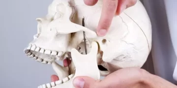 سندروم مفصل گیجگاهی فکی