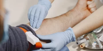 anti tpo در آزمایش خون