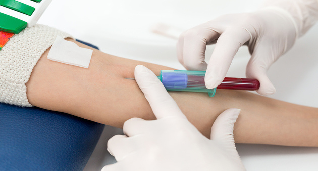 آزمایش خون، آزمایشی مهم برای بررسی وضعیت سلامت جسم