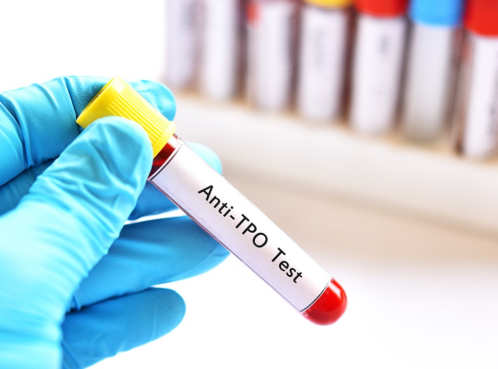 تست anti tpo در آزمایش خون، تستی مهم در بررسی سلامتی انسان