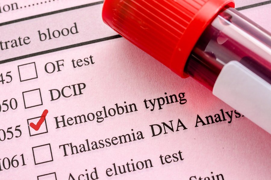  بررسی مقدار هموگلوبین خون؛ از نتایج مهم آزمایش خون