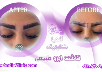 کلینیک زیبایی آندیا