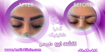کلینیک زیبایی آندیا