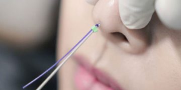 ترمیم بینی بدون جراحی چگونه است