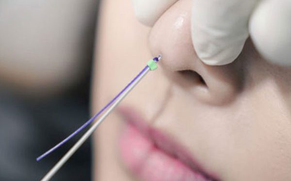 ترمیم بینی بدون جراحی چگونه است؟ 1 ترمیم بینی بدون جراحی چگونه است