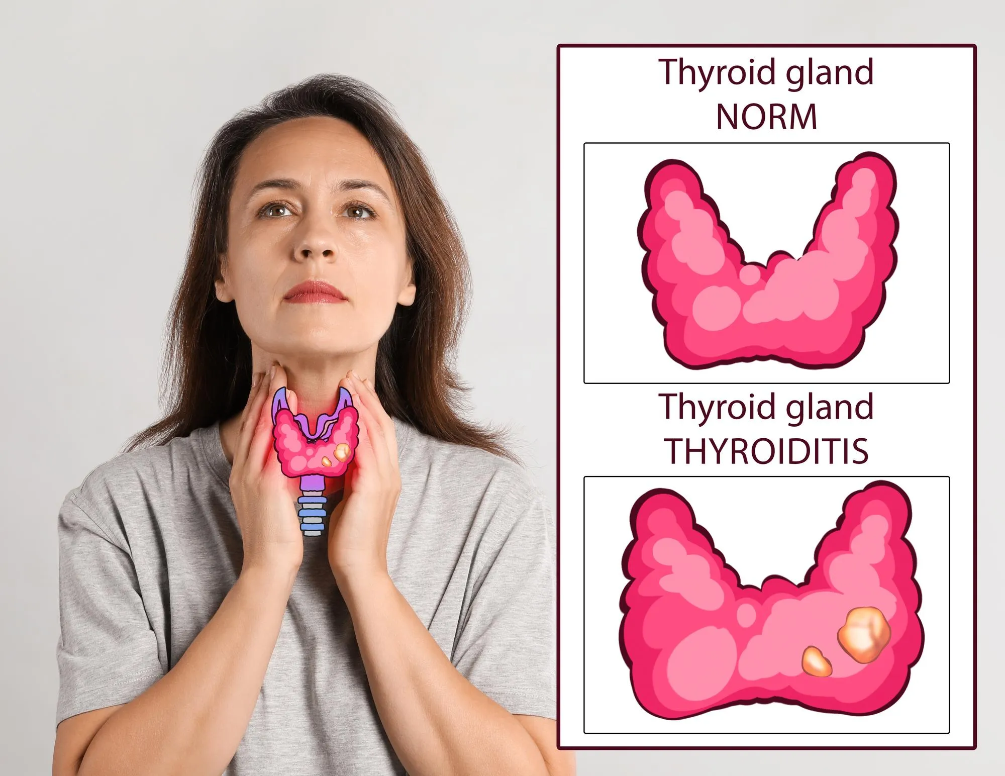 woman illustration thyroid gland