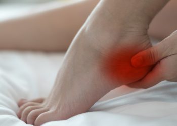 درمان خار پاشنه پا