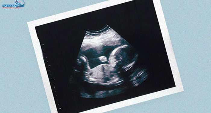 آیا سونوگرافی زیاد در بارداری ضرر دارد