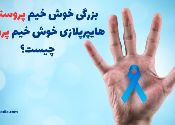 بزرگی خوش خیم پروستات یا هایپرپلازی خوش خیم پروستات