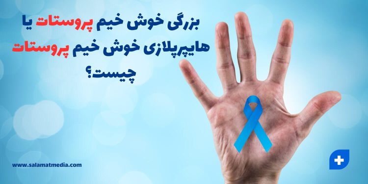 بزرگی خوش خیم پروستات | هایپرپلازی خوش خیم پروستات + روش های درمان 1 بزرگی خوش خیم پروستات یا هایپرپلازی خوش خیم پروستات