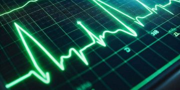 آیا مشکل قلبی با نوار قلب مشخص می شود؟- تشخیص مشکل قلبی با نوار قلب