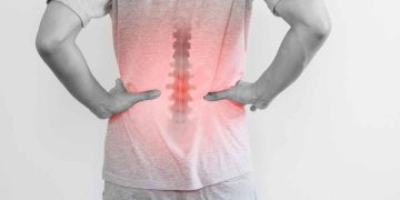 درمان دیسک کمر به روش غیر جراحی