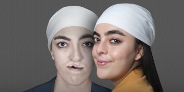 کیس جراحی دکتر پارسا بهنیا