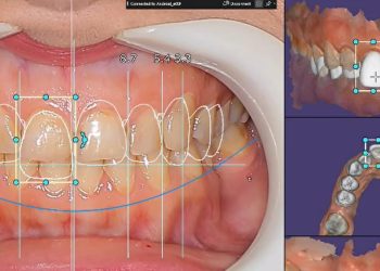 مزایای شرکت در دوره_های دندانسازی دیجیتال - تصویر 3
