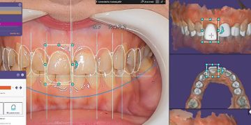 مزایای شرکت در دوره_های دندانسازی دیجیتال - تصویر 3