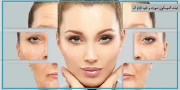 لیفت ابرو، لیفت آندوسکوپی صورت و جراحی بینی گوشتی