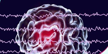 نقشه مغزی، نوروفیدبک و درمان اختلال شخصیت