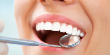 روش های طبیعی برای تقویت مینای دندان