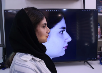 بینی استخوانی