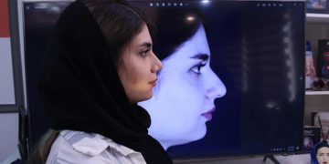 بینی استخوانی