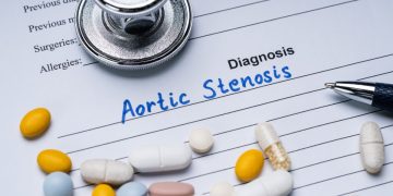 پیشگیری از تنگی کانال نخاعی