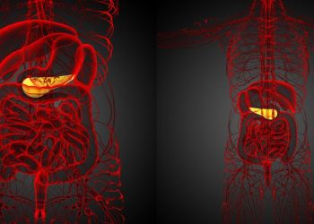 روش های جراحی سنگ کیسه صفرا