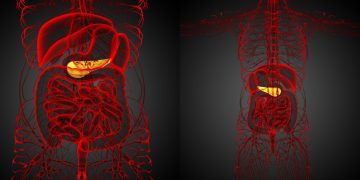 روش های جراحی سنگ کیسه صفرا
