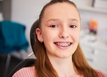 هزینه ارتودنسی ثابت تک فک