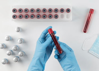 انجام چکاپ کامل