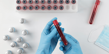 انجام چکاپ کامل