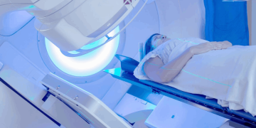 رادیوتراپی