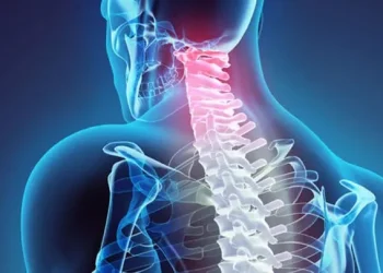 جراحی دیسک گردن در تهران