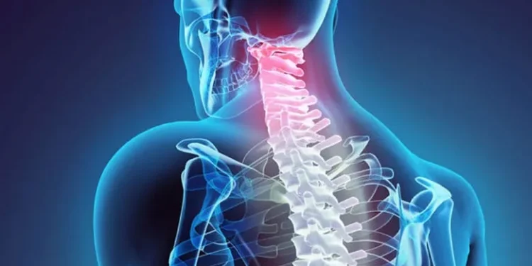 جراحی دیسک گردن در تهران؛ راهکاری مدرن برای درمان دردهای مزمن 1 جراحی دیسک گردن در تهران
