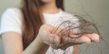 درمان ریزش مو