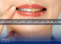 چگونه با روشهای نوین زیبایی دندان، لبخندی جذاب داشته باشیم؟ 9 زیبایی دندان