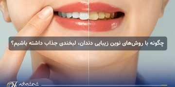 زیبایی دندان