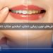 زیبایی دندان