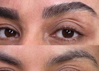 فیبروز با میکرو چه فرقی دارد