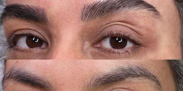 فیبروز با میکرو چه فرقی دارد