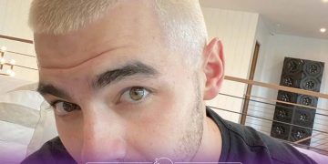 آیا دکلره باعث ریزش مو می شود